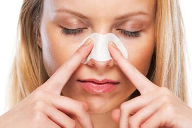 Sudurraren rinoplastia