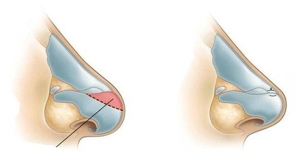 Sudur forma zuzentzea