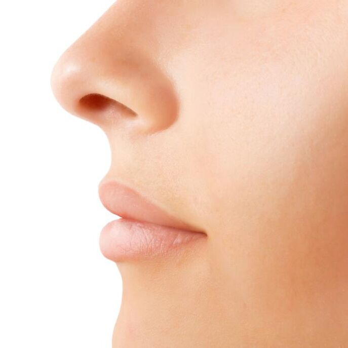 rinoplastia irekiaren emaitza